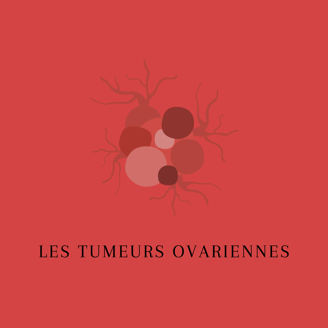 Les tumeurs ovariennes