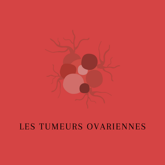 Les tumeurs ovariennes
